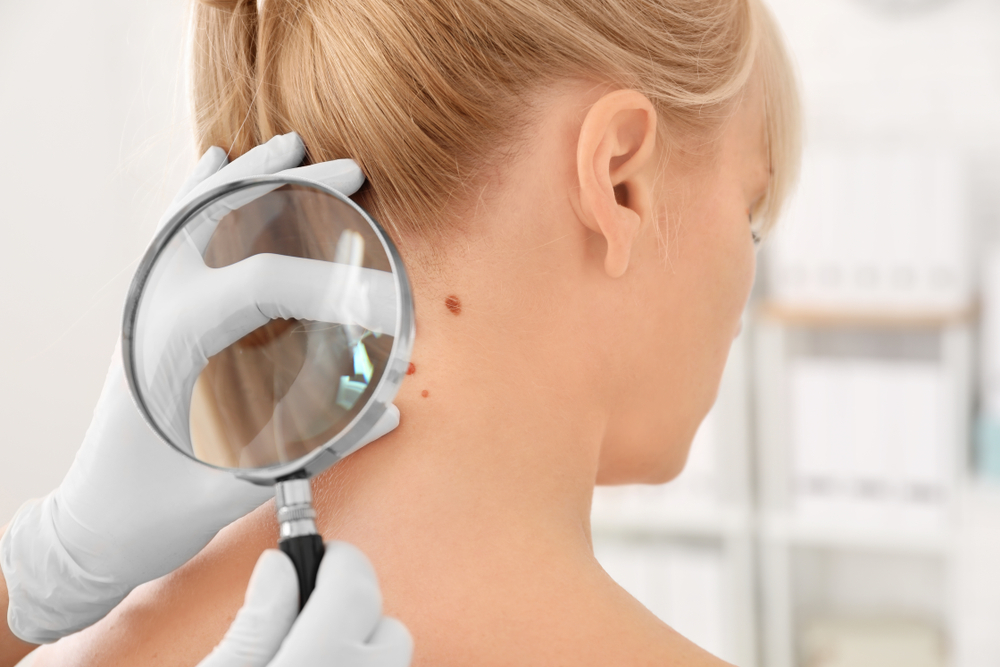Skin Cancer Awareness | Deerfield Beach, FL