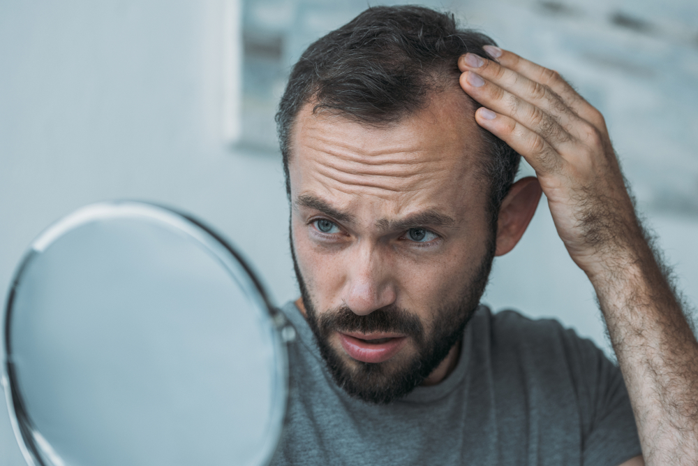 Understanding Alopecia: Types, Causes, and Treatment Options