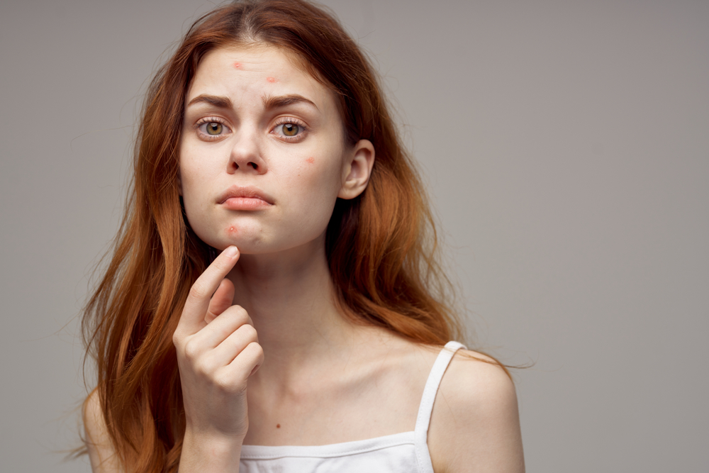When to See a Dermatologist vs. Self Treatment for Acne