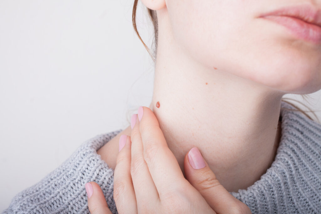 Basal Cell vs Squamous Cell Carcinoma: Two Common Types of Skin Cancer Explained