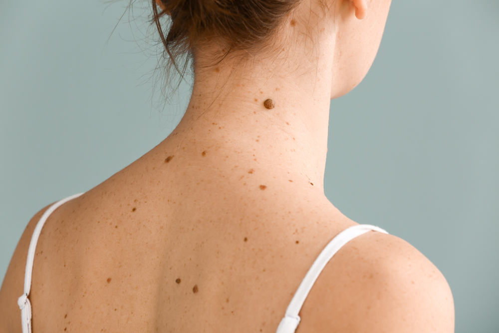 How Comprehensive Skin Cancer Screenings Can Safeguard Your Beauty and Health