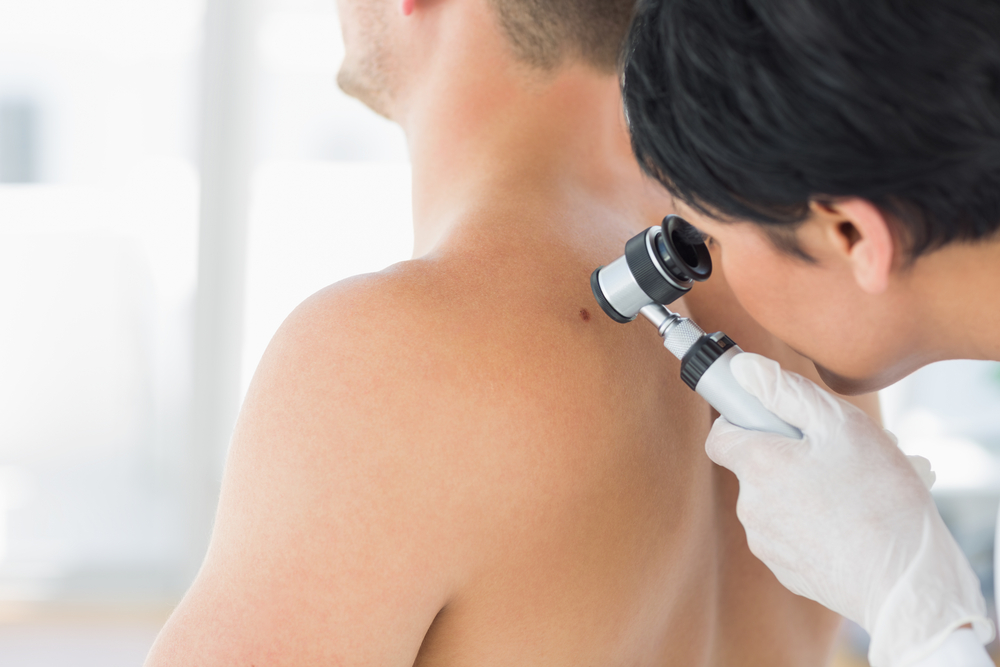 Skin Cancer Awareness Month: Yearly Skin Exams and the ABCs of Moles