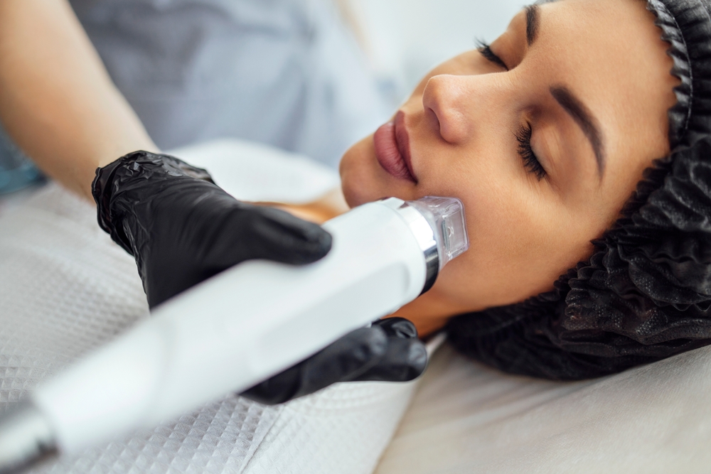 Microneedling: Stimulating Collagen Production for Smoother, Firmer Skin