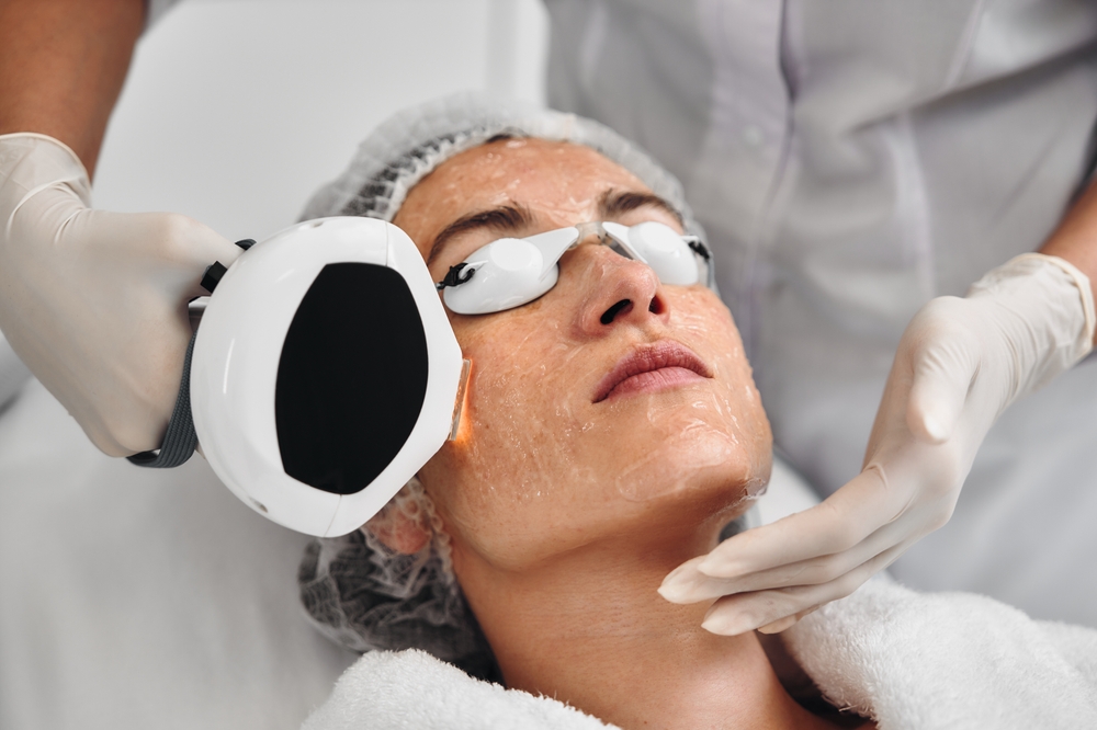 Rosacea Relief: Understanding Triggers, Symptoms, and Effective Treatments