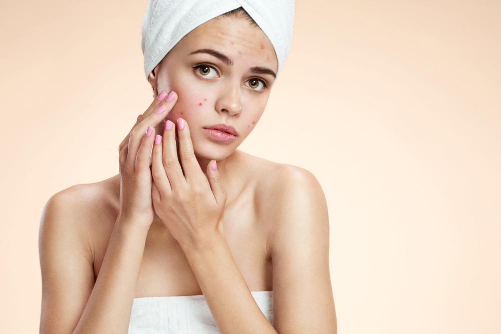 Acne in Teens: Tips for Managing Breakouts